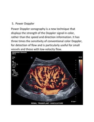5. Power Doppler
Power Doppler sonography is a new technique that
displays the strength of the Doppler signal in color,
rather than the speed and direction information. It has
three times the sensitivity of conventional color Doppler,
for detection of flow and is particularly useful for small
vessels and those with low-velocity flow.
 