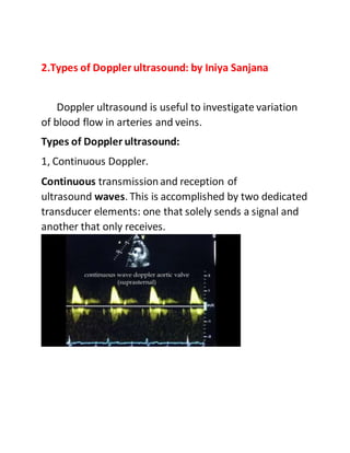 2.Types of Doppler ultrasound: by Iniya Sanjana
Doppler ultrasound is useful to investigate variation
of blood flow in art...