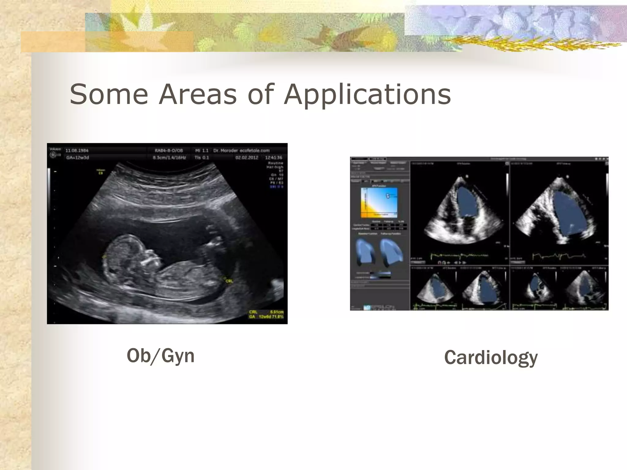 Basics of Diagnostic Ultrasound | PPT
