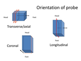 Orientation of probe
Head Feet
Transverse/axial
Head
Feet
Feet
Head
Coronal Longitudinal
 