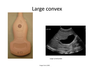 Large convex
Large curved probe
Images from UCMC
 