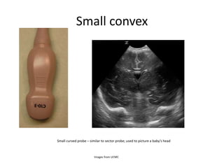 Small convex
Small curved probe – similar to sector probe; used to picture a baby’s head
Images from UCMC
 