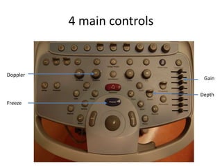 4 main controls
Doppler
Freeze
Depth
Gain
 
