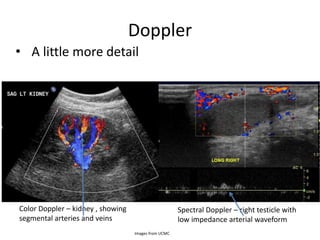 Doppler
Images from UCMC
Color Doppler – kidney , showing
segmental arteries and veins
Spectral Doppler – right testicle with
low impedance arterial waveform
• A little more detail
 