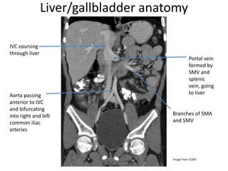 Liver/gallbladder anatomy
IVC coursing
through liver
Aorta passing
anterior to IVC
and bifurcating
into right and left
common iliac
arteries
Portal vein
formed by
SMV and
splenic
vein, going
to liver
Branches of SMA
and SMV
Image from UCMC
 