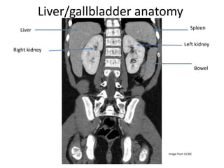 Liver/gallbladder anatomy
Spleen
Bowel
Liver
Right kidney
Left kidney
Image from UCMC
 