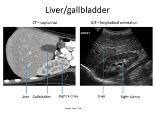 Liver/gallbladder
CT – sagittal cut U/S – longitudinal orientation
Liver Gallbladder Right kidney Liver Right kidney
Images from UCMC
 