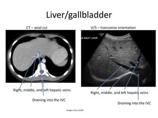Liver/gallbladder
CT – axial cut
Right, middle, and left hepatic veins
Right, middle, and left hepatic veins
Draining into the IVC
Draining into the IVC
U/S – transverse orientation
Images from UCMC
 
