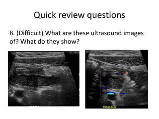 Quick review questions
8. (Difficult) What are these ultrasound images
of? What do they show?
 