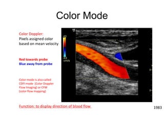 Ultrasound Basics pptx - Ultrasound Basics Pptx 14 320