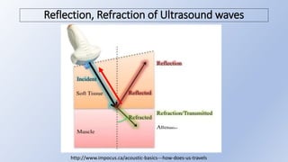 Ultrasound basics for Nephrologists.pptx