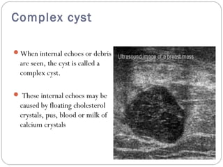 Ultrasound breast mass Slide 14