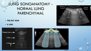 LUNG SONOANATOMY -
NORMAL LUNG
PARENCHYMAL
• THE BAT SIGN
• A LINE
 