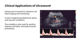 Ultrasound Diagnostic and treatment causes and effects | PPTX