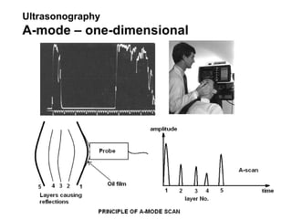 Ultrasonography   A- mode  – one-dimensional 