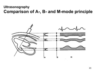 Ultrason ography   Comparison of A-, B- and M-mode principle 