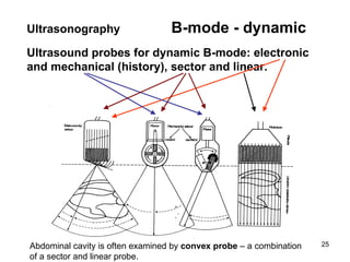 Ultrasound probes for dynamic B-mode: electronic and mechanical  (history) , sector and linear .  Ultrasonography   B-mode - dynamic Abdominal cavity is often examined by  convex probe  – a combination of a sector and linear probe. 