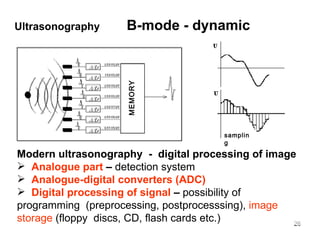 Modern ultrasonography  -  digital processing of image Analogue part  –  detection system Analogue-digital converters (ADC) Digital processing of signal  –  possibility of  programming  (preprocessing, postprocesssing),  image storage  (floppy  discs, CD, flash cards etc.) Ultrasonography   B-mode - dynamic MEMORY sampling 