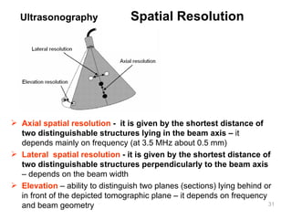 Axial spatial resolution  -  it is given by the shortest distance of two distinguishable structures lying in the beam axis –  it depends mainly on frequency (at 3.5 MHz about 0.5 mm) Lateral  spatial resolution  - it is given by the shortest distance of two distinguishable structures perpendicularly to the beam axis  – depends on the beam width Elevation  – ability to distinguish two planes (sections) lying behind or in front of the depicted tomographic plane – it depends on frequency and beam geometry Ultrasonography   Spatial Resolution 