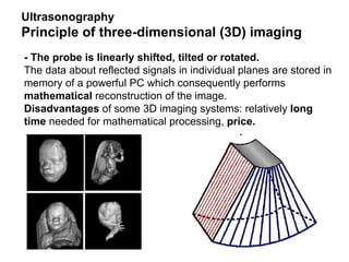 - The probe is linearly shifted, tilted or rotated. The data about reflected signals in individual planes are stored in memory of a powerful PC which consequently performs  mathematical  reconstruction of the image.  Disadvantages  of some 3D imaging systems: relatively  long time  needed for mathematical processing,  price . Ultrasonography  Principle of three-dimensional (3D) imaging 