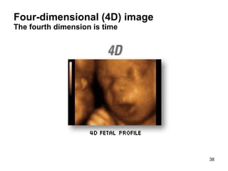 Four-dimensional (4D) image The fourth dimension is time 