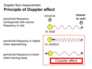 perceived frequency corresponds with source frequency in rest perceived frequency is higher when approaching perceived frequency is lower when moving away Doppler flow measurement Principle of Doppler effect 