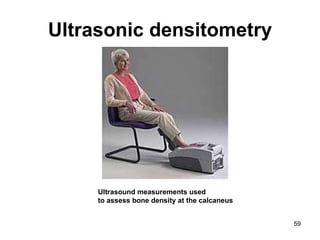 Ultrasonic densitometry Ultrasound measurements used  to assess bone density at the calcaneus  