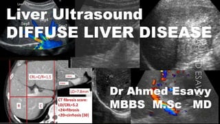 Ultrasound diffuse liver disease all things fibrosis,cirrhosis,us scoring,ce lrad,fibroscan,hepatitis,psc,aih,pbc