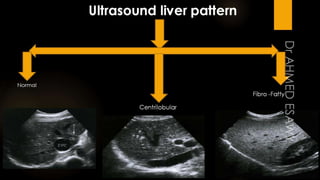 Ultrasound diffuse liver disease all things fibrosis,cirrhosis,us scoring,ce lrad,fibroscan,hepatitis,psc,aih,pbc