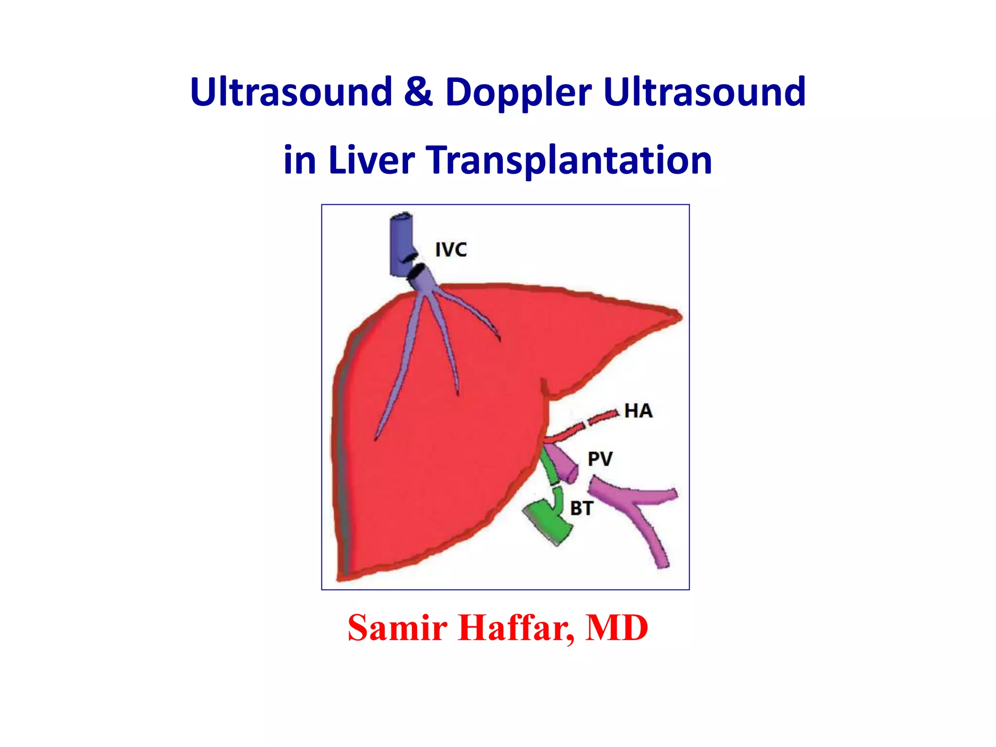 Ultrasound & doppler ultrasound in liver transplantation | PPTX