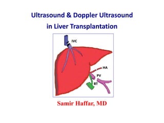 Ultrasound & Doppler Ultrasound
in Liver Transplantation
Samir Haffar, MD
 
