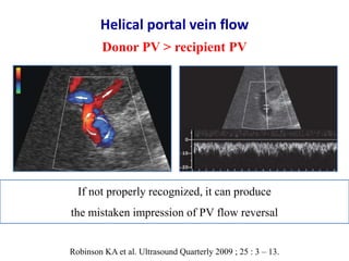 Ultrasound & doppler ultrasound in liver transplantation | PPTX
