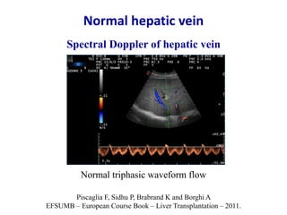 Ultrasound & doppler ultrasound in liver transplantation | PPTX