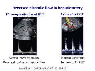 Ultrasound & doppler ultrasound in liver transplantation | PPTX