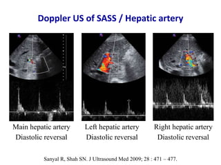 Ultrasound & doppler ultrasound in liver transplantation | PPTX