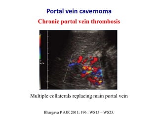 Ultrasound & doppler ultrasound in liver transplantation | PPTX