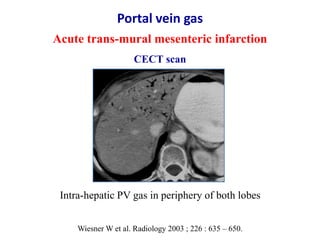 Ultrasound & doppler ultrasound in liver transplantation | PPTX