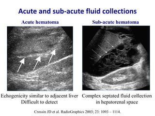 Ultrasound & doppler ultrasound in liver transplantation | PPTX
