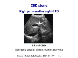 Ultrasound Doppler Ultrasound In Liver Transplantation PPTX