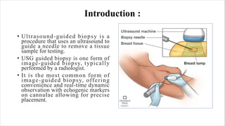 Ultrasound Guided Biopsy ppt . ANKITA KUMARIpdf | PDF
