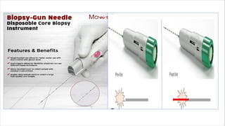 Ultrasound Guided Biopsy ppt . ANKITA KUMARIpdf | PDF