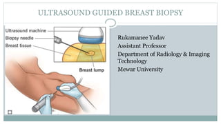 ULTRASOUND GUIDED BREAST BIOPSY
Rukamanee Yadav
Assistant Professor
Department of Radiology & Imaging
Technology
Mewar University
 