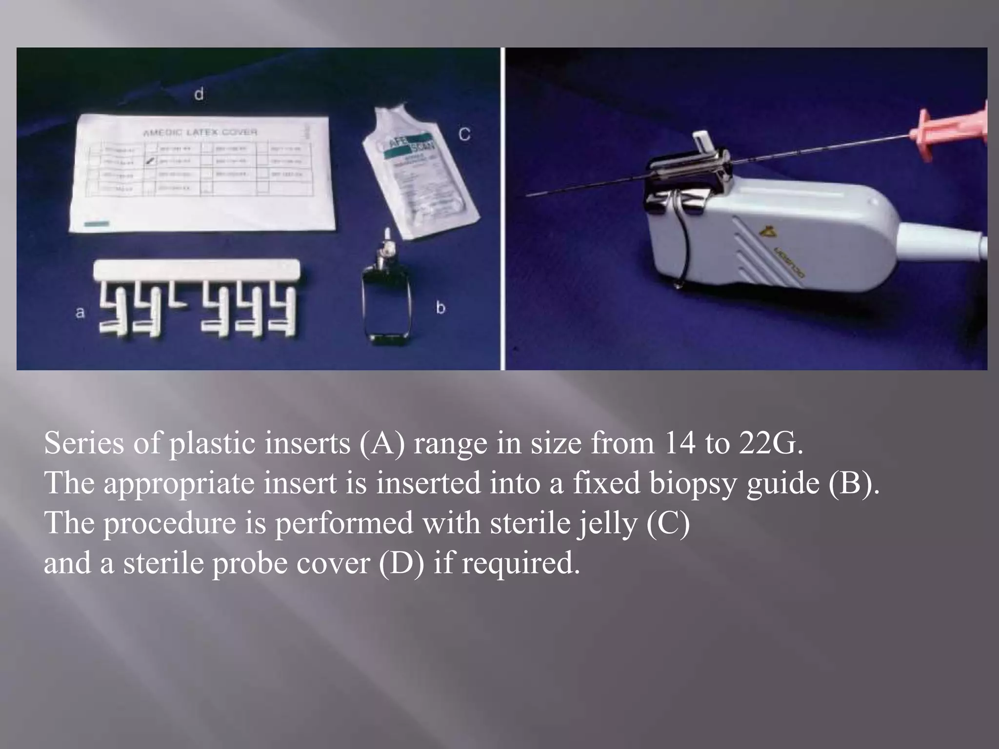 Ultrasound guided interventional procedure | PPTX