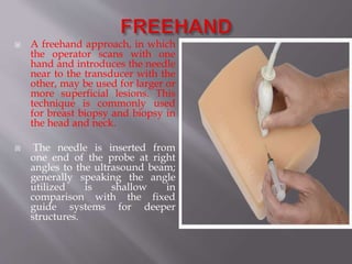  A freehand approach, in which
the operator scans with one
hand and introduces the needle
near to the transducer with the
other, may be used for larger or
more superficial lesions. This
technique is commonly used
for breast biopsy and biopsy in
the head and neck.
 The needle is inserted from
one end of the probe at right
angles to the ultrasound beam;
generally speaking the angle
utilized is shallow in
comparison with the fixed
guide systems for deeper
structures.
 
