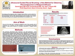 Ultrasound Guided Pleural Brushing: a New Method for Obtaining
Pleural Specimen in Malignant Effusion
Gamal Agmy MD FCCP, Yousef Ahmed MD and Alaa T Hassan MD
Chest Department, Assiut University, Assiut , Egypt
Introduction
Encouraging positive diagnostic yields in malignant pleural effusion could be obtained by
pleural brushing performed through two techniques, the first was closed and the second
was thoracoscopic. Until now the ultrasound guided pleural brushing is not included
within these techniques and its diagnostic yield therefore is not evaluated [1,2,3],
Methods
Conclusions
Introduction Results
References
Ultrasound-guided pleural brushing is a new method for obtaining pleural specimens. It is a
simple and relatively safe procedure. This technique provides additional diagnostic yield in
malignant pleural effusion. We recommend it beside others in our diagnostic practice for
suspicious malignant effusion especially when thoracoscopy not available
1-A.Renshaw,B. Dean,K. Antman,D. Sugarbaker,E. Cibas, The Role of Cytologic Evaluation of Pleural
Fluid in the Diagnosis of Malignant Mesothelioma. Chest (1997)111:106–109.
2-A.Emad, G. Rezaian, Closed percutaneous pleural brushing: a new method for diagnosis of malignant
pleural effusions. Respir Med 1998; 92: 659-663.
3-L. Shaaban, Y. Ahmed, Value of thoracoscopic pleural brush in the diagnosis of exudative pleural
effusion Egyptian, J. Chest Dis. Tuberculosis 61 (2012) 385–389.
This prospective interventional study conducted in the Chest Department – Assiut
University Hospital during the period from July 2014 to September 2015. Patients who had
highly suspicious malignant pleural effusion (clinical, radiological, and laboratory) were
hospitalized and enrolled in this study. Patients with bleeding tendency or coagulation
profile abnormalities were excluded from the study. Patients were also excluded from this
study if the etiology of effusion was proved to be benign. Informed written consent was
obtained from all patients. The equipment used in our study were ultrasound apparatus
(ALOKA– Ultrasound – SSD – 3500SV), biopsy forceps (KARL – STORZ – Germany 10329L
– BS), the bronchoscopic cleaning brush (PENTAX CS6002SN) trocar and cannula of
Cope’s needle and rubber inlet seal (this specimen usually fixed at the proximal port of
light bronchoscope channel) ,and the semi rigid thoracoscope (LTF; Olympus; Tokyo,
Japan) .Thoracocentesis, pleural brushing and biopsy forceps of the pleura were
performed for all enrolled patients in the ultrasound unit of the Chest Department while
thoracoscopy was done in the endoscopy unit only for patients in whom the diagnosis
could not be achieved by these procedures
LOGO OF YOU
UNIVERSITY/INSTITUTION
Aim of Work
The aim of this study was to evaluate the diagnostic yield of this procedure and its
contributions as a technique not used previously in the interventional pulmonology
practice to obtain pleural specimen for cytological examination in malignant pleural
effusion.
Figure 1 Biopsyforceps (KARL – STORZ – Germany 10329 – BS). Figure 2 (top-down) PENTAX cleaning brush, Cope’s cannula,
Cope’s trocar and the rubber piece.
Procedure Diagnostic yield Sole diagnostic technique
PFC 9 (41%) 1 (4%)
PB 9 (41%) 3 (14%)
BFP 15 (68%) 7 (32%)
PFC + BFP 16 (72%)
PB + PFC 12 (55%)
PB + BFP 18 (82%)
PB + PFC + BFP 19 (86%)
Table (1) Positive yield of the individual procedures and their combinations
in the malignant studied patients (number = 22)
PFC: Pleural fluid cytology, PB: Pleural brush, BFP: Biopsy forceps of pleura
Figure 4: :Ultrasound picture showed the brush
(arrow) inside the pleural cavityFigure 3:Positive yield of the individual procedures and their
combinations in the malignant studied patients (number =
22)
 