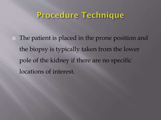 

The patient is placed in the prone position and
the biopsy is typically taken from the lower

pole of the kidney if there are no specific
locations of interest.

 