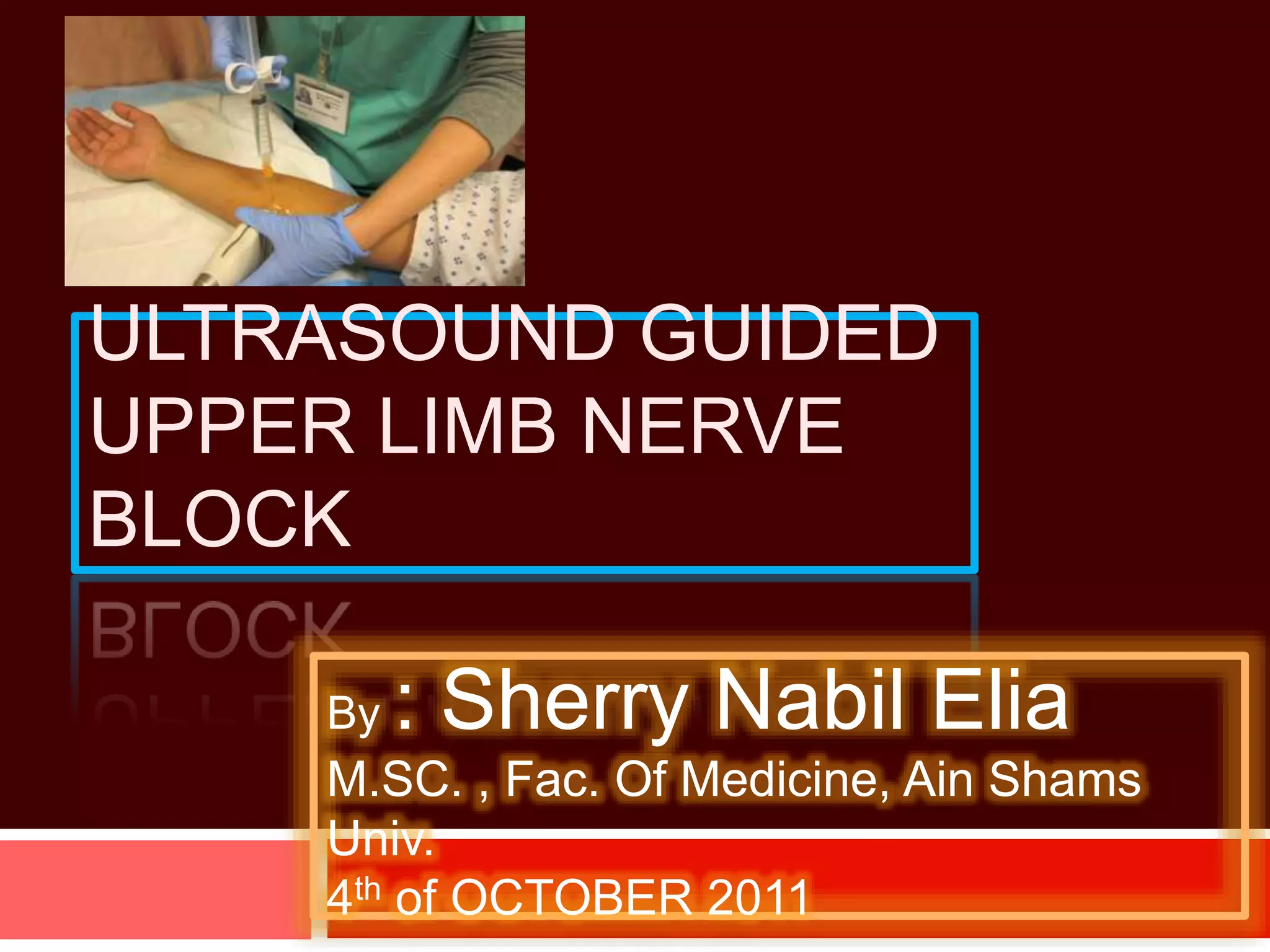 Ultrasound guided upper limb nerve block | PPTX