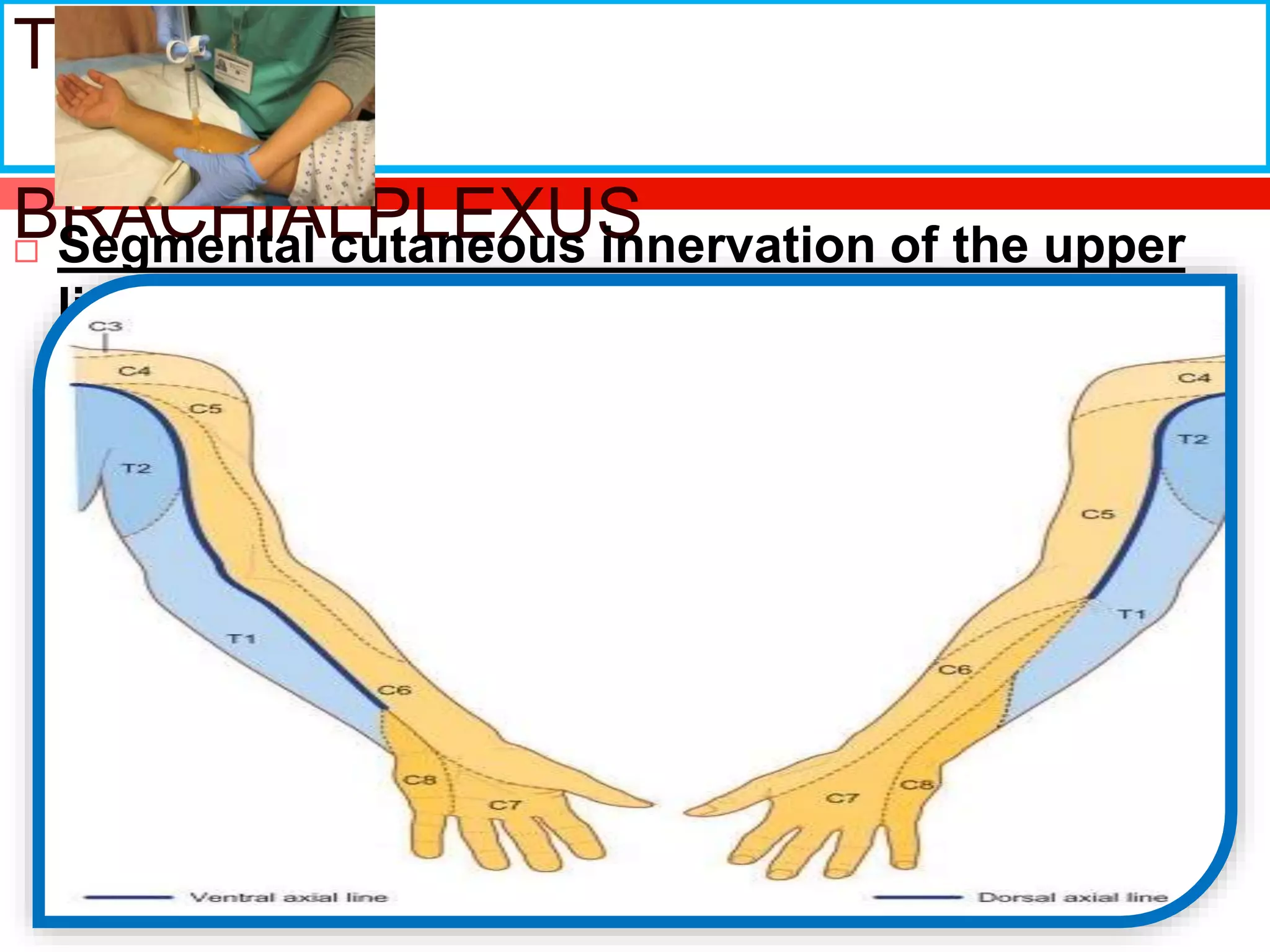Ultrasound guided upper limb nerve block | PPT