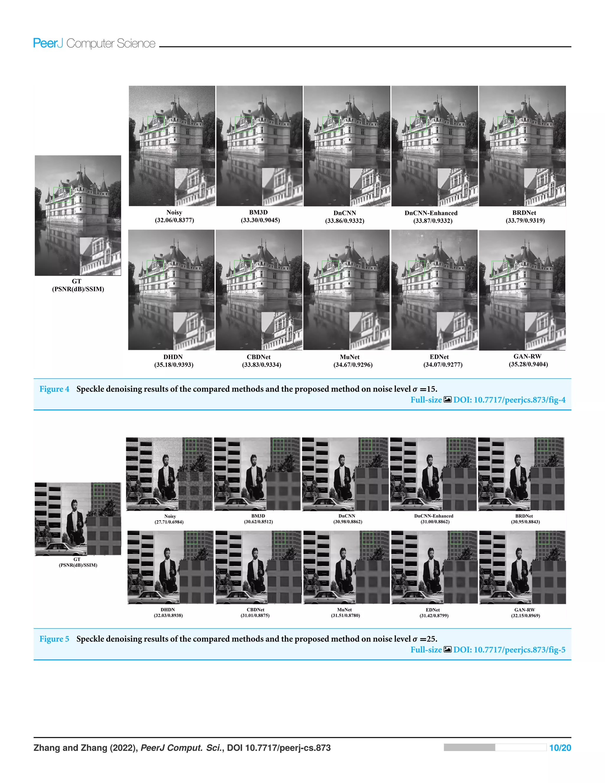 Figure 4 Speckle denoising results of the compared methods and the proposed method on noise level σ =15.
Full-size DOI: 10.7717/peerjcs.873/fig-4
Figure 5 Speckle denoising results of the compared methods and the proposed method on noise level σ =25.
Full-size DOI: 10.7717/peerjcs.873/fig-5
Zhang and Zhang (2022), PeerJ Comput. Sci., DOI 10.7717/peerj-cs.873 10/20
 
