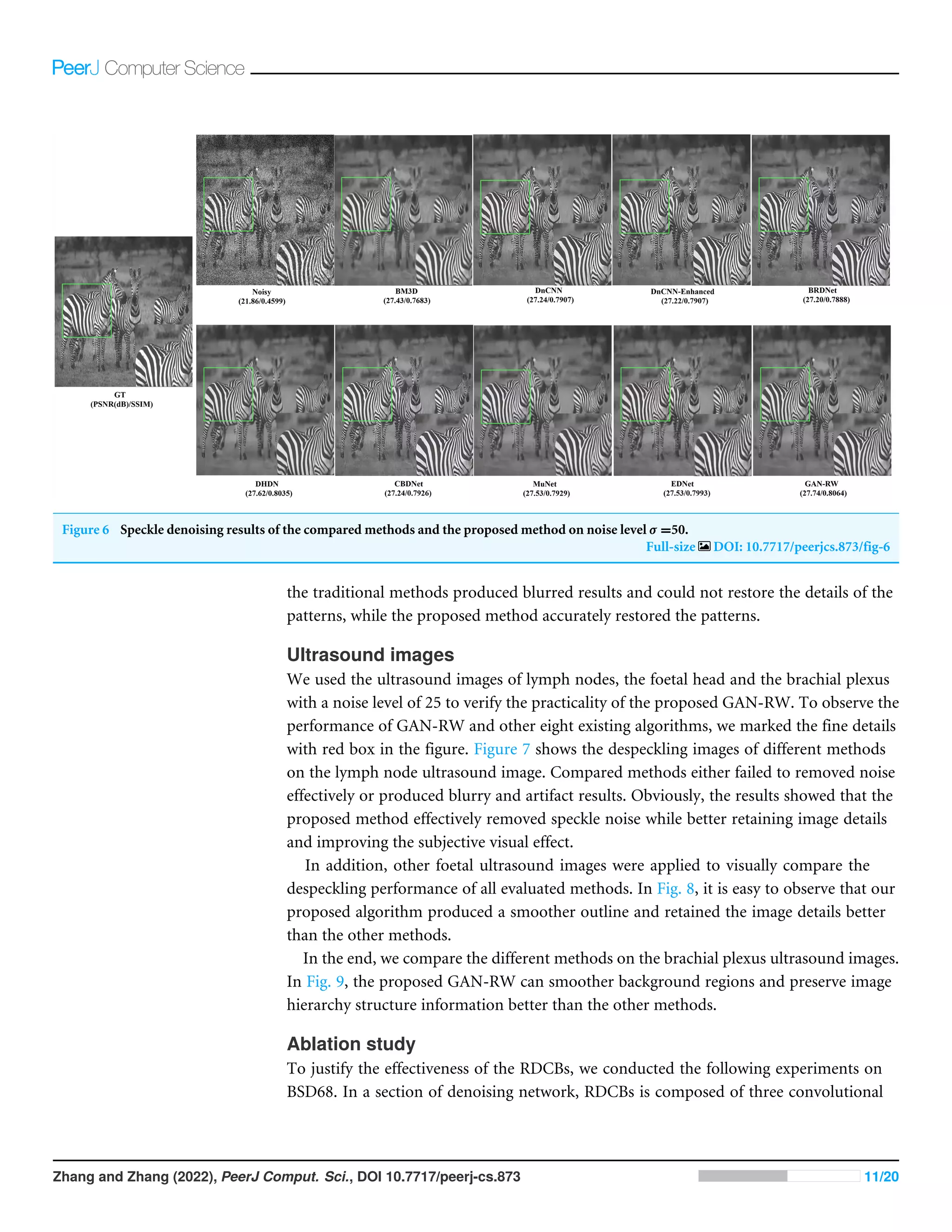 Figure 6 Speckle denoising results of the compared methods and the proposed method on noise level σ =50.
Full-size DOI: 10.7717/peerjcs.873/fig-6
the traditional methods produced blurred results and could not restore the details of the
patterns, while the proposed method accurately restored the patterns.
Ultrasound images
We used the ultrasound images of lymph nodes, the foetal head and the brachial plexus
with a noise level of 25 to verify the practicality of the proposed GAN-RW. To observe the
performance of GAN-RW and other eight existing algorithms, we marked the fine details
with red box in the figure. Figure 7 shows the despeckling images of different methods
on the lymph node ultrasound image. Compared methods either failed to removed noise
effectively or produced blurry and artifact results. Obviously, the results showed that the
proposed method effectively removed speckle noise while better retaining image details
and improving the subjective visual effect.
In addition, other foetal ultrasound images were applied to visually compare the
despeckling performance of all evaluated methods. In Fig. 8, it is easy to observe that our
proposed algorithm produced a smoother outline and retained the image details better
than the other methods.
In the end, we compare the different methods on the brachial plexus ultrasound images.
In Fig. 9, the proposed GAN-RW can smoother background regions and preserve image
hierarchy structure information better than the other methods.
Ablation study
To justify the effectiveness of the RDCBs, we conducted the following experiments on
BSD68. In a section of denoising network, RDCBs is composed of three convolutional
Zhang and Zhang (2022), PeerJ Comput. Sci., DOI 10.7717/peerj-cs.873 11/20
 